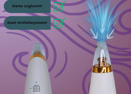 STEGGER - Mee eter Verwijderaar - Blackhead Remover - Mee eters Verwijderen - Mee eters Verwijderen Apparaat - MBDeals.nl