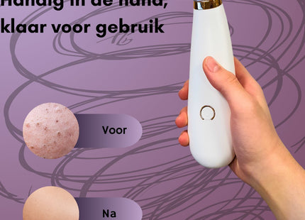 STEGGER - Mee eter Verwijderaar - Blackhead Remover - Mee eters Verwijderen - Mee eters Verwijderen Apparaat - MBDeals.nl