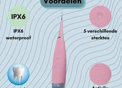 STEGGER - Tandsteen Verwijderaar - Tandsteenverwijderaars - Tandplak Verwijderaar - Tandsteen - Tanden Polijsten - MBDeals.nl